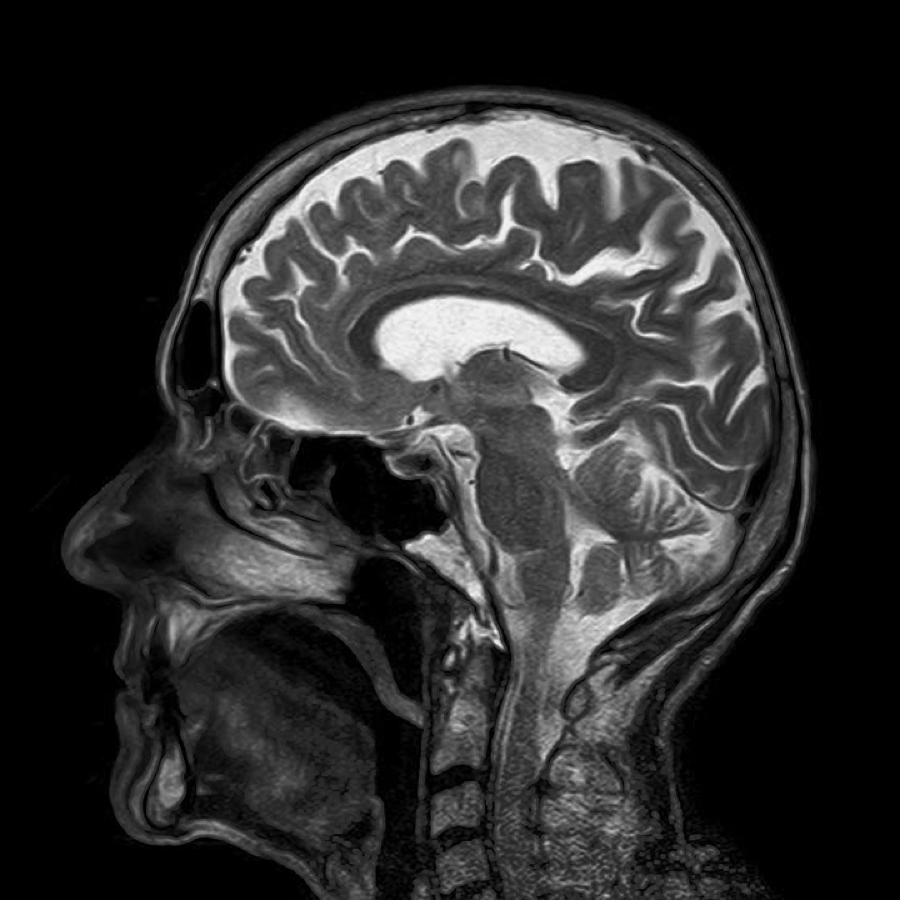 Safer way to administer brain MRIs